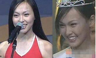 龅牙娱乐吃瓜,揭秘娱乐圈吃瓜背后的真相与笑料 第1张 龅牙娱乐吃瓜,揭秘娱乐圈吃瓜背后的真相与笑料 第1张